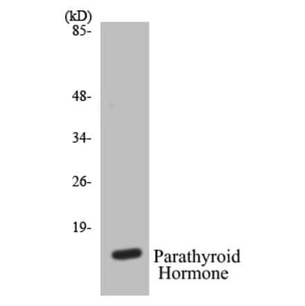 Western Blot - Parathyroid Hormone Cell Based ELISA Kit (CB5533) - Antibodies.com