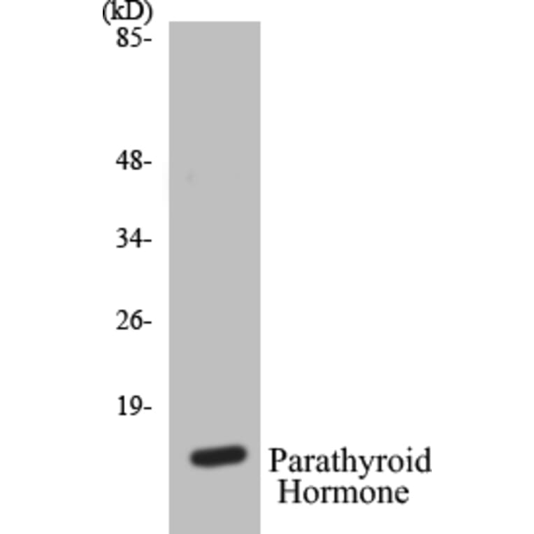 Western Blot - Parathyroid Hormone Cell Based ELISA Kit (CB5533) - Antibodies.com