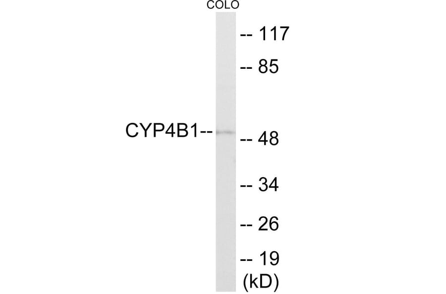 Western Blot - Cytochrome P45 04B1 Cell Based ELISA Kit (CB6141) - Antibodies.com
