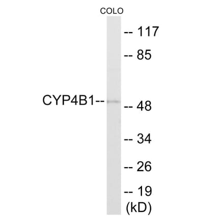 Western Blot - Cytochrome P45 04B1 Cell Based ELISA Kit (CB6141) - Antibodies.com