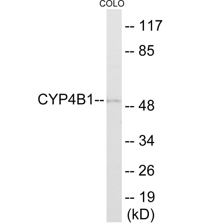 Western Blot - Cytochrome P45 04B1 Cell Based ELISA Kit (CB6141) - Antibodies.com