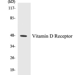 Western Blot - Vitamin D Receptor Cell Based ELISA Kit (CB5726) - Antibodies.com