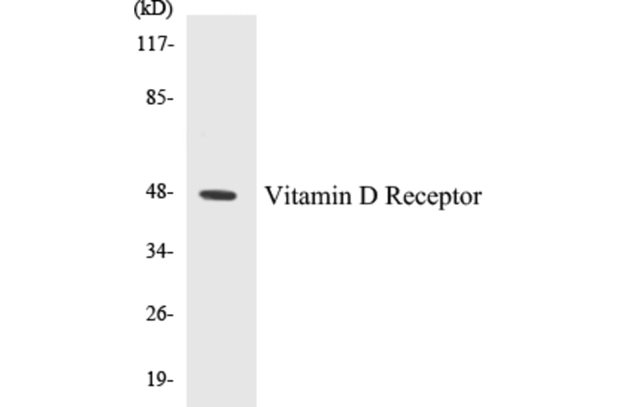 Western Blot - Vitamin D Receptor Cell Based ELISA Kit (CB5726) - Antibodies.com