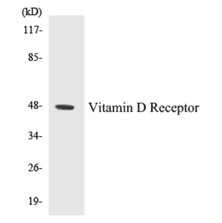 Western Blot - Vitamin D Receptor Cell Based ELISA Kit (CB5726) - Antibodies.com