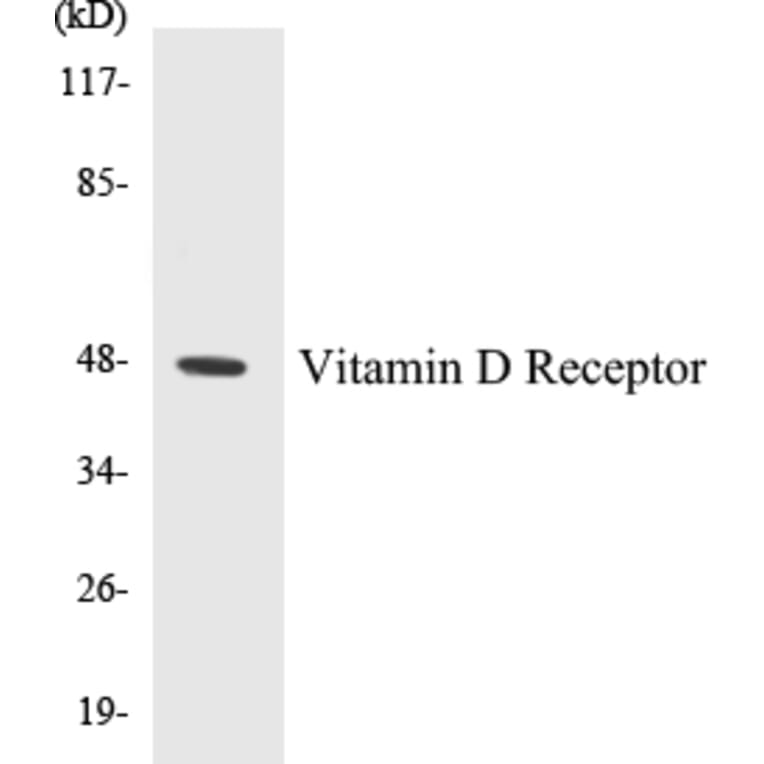 Western Blot - Vitamin D Receptor Cell Based ELISA Kit (CB5726) - Antibodies.com