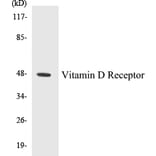 Western Blot - Vitamin D Receptor Cell Based ELISA Kit (CB5726) - Antibodies.com