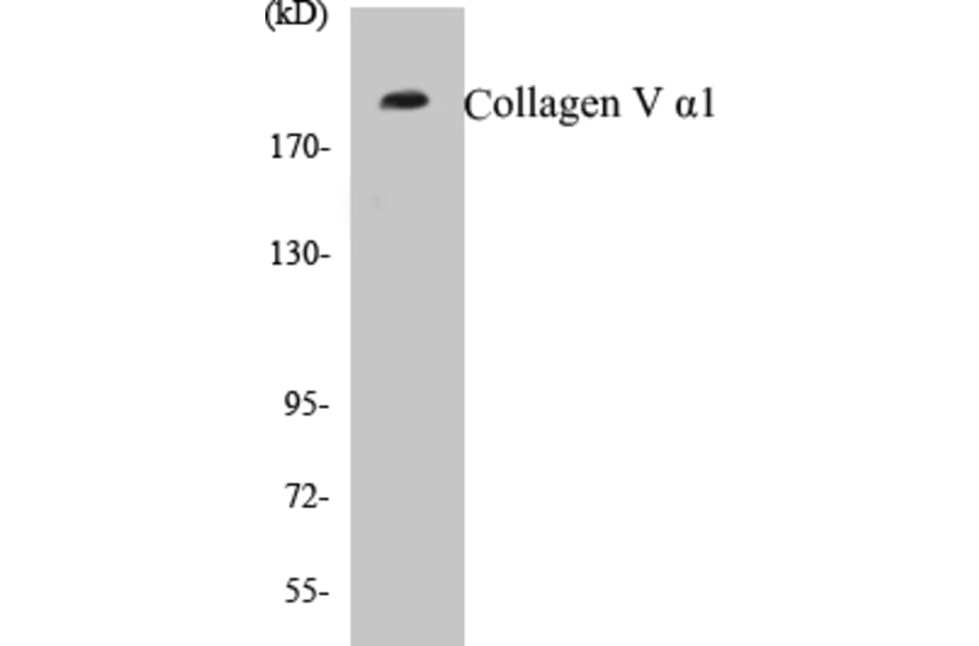 Western Blot - Collagen V alpha 1 Cell Based ELISA Kit (CB5157) - Antibodies.com