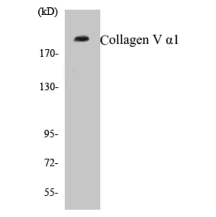 Western Blot - Collagen V alpha 1 Cell Based ELISA Kit (CB5157) - Antibodies.com