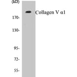 Western Blot - Collagen V alpha 1 Cell Based ELISA Kit (CB5157) - Antibodies.com