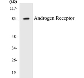 Western Blot - Androgen Receptor Cell Based ELISA Kit (CB5040) - Antibodies.com