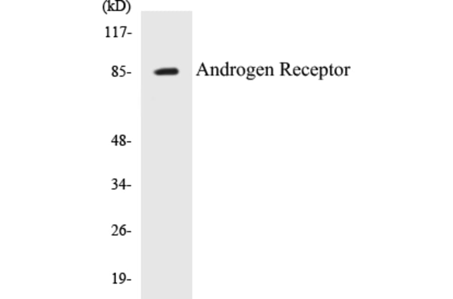 Western Blot - Androgen Receptor Cell Based ELISA Kit (CB5040) - Antibodies.com