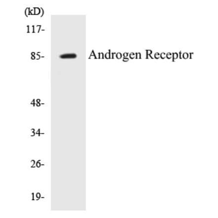Western Blot - Androgen Receptor Cell Based ELISA Kit (CB5040) - Antibodies.com