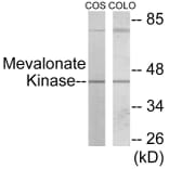 Western Blot - Mevalonate Kinase Cell Based ELISA Kit (CB5956) - Antibodies.com