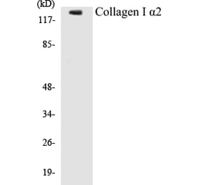 Western Blot - Collagen alpha I Cell Based ELISA Kit (CB5153) - Antibodies.com