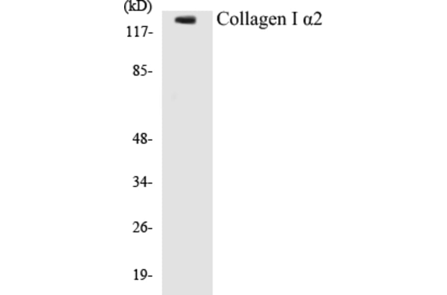 Western Blot - Collagen alpha I Cell Based ELISA Kit (CB5153) - Antibodies.com