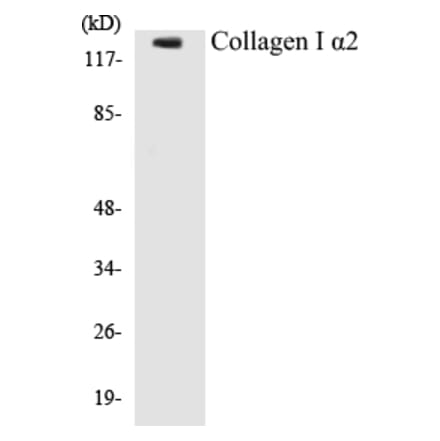 Western Blot - Collagen alpha I Cell Based ELISA Kit (CB5153) - Antibodies.com