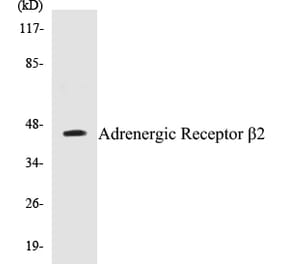 Western Blot - Adrenergic Receptor beta 2 Cell Based ELISA Kit (CB5025) - Antibodies.com
