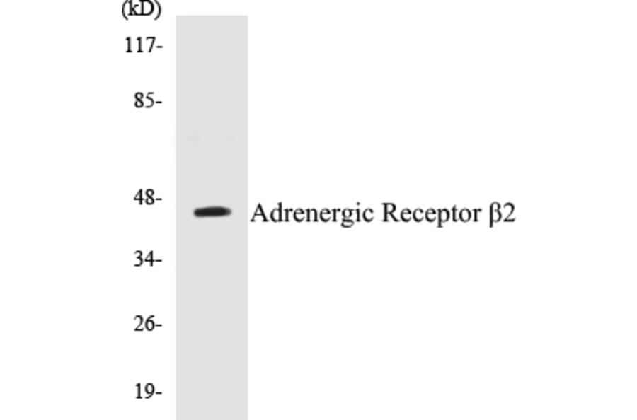 Western Blot - Adrenergic Receptor beta 2 Cell Based ELISA Kit (CB5025) - Antibodies.com