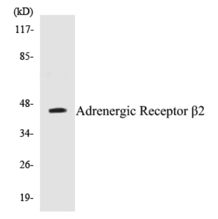 Western Blot - Adrenergic Receptor beta 2 Cell Based ELISA Kit (CB5025) - Antibodies.com