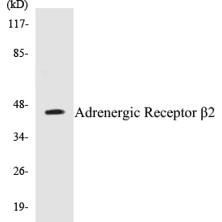 Western Blot - Adrenergic Receptor beta 2 Cell Based ELISA Kit (CB5025) - Antibodies.com