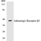 Western Blot - Adrenergic Receptor beta 2 Cell Based ELISA Kit (CB5025) - Antibodies.com