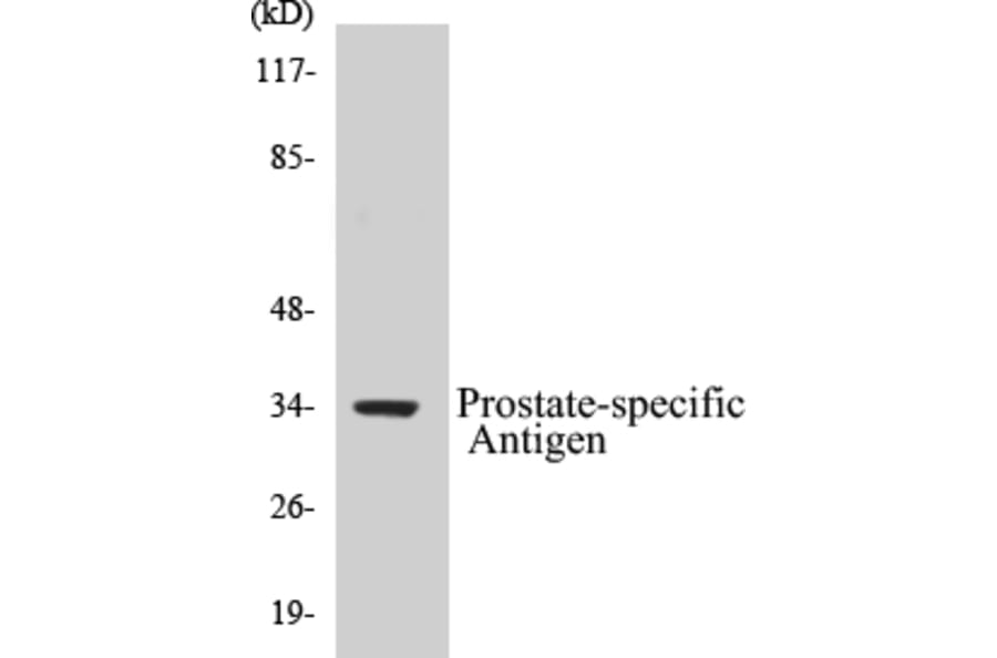 Western Blot - Prostate-specific Antigen Cell Based ELISA Kit (CB5590) - Antibodies.com