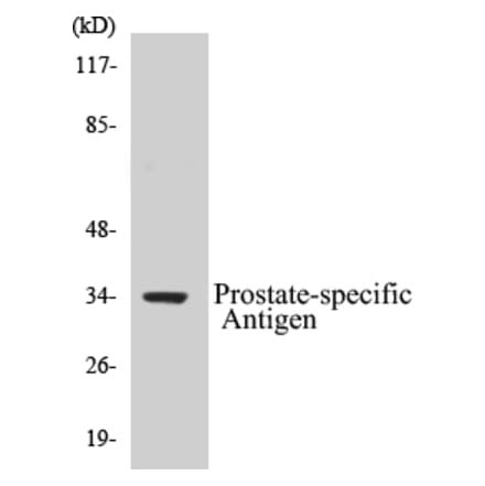 Western Blot - Prostate-specific Antigen Cell Based ELISA Kit (CB5590) - Antibodies.com