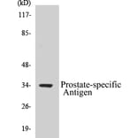 Western Blot - Prostate-specific Antigen Cell Based ELISA Kit (CB5590) - Antibodies.com