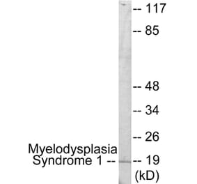 Western Blot - Myelodysplasia Syndrome 1 Cell Based ELISA Kit (CB5991) - Antibodies.com