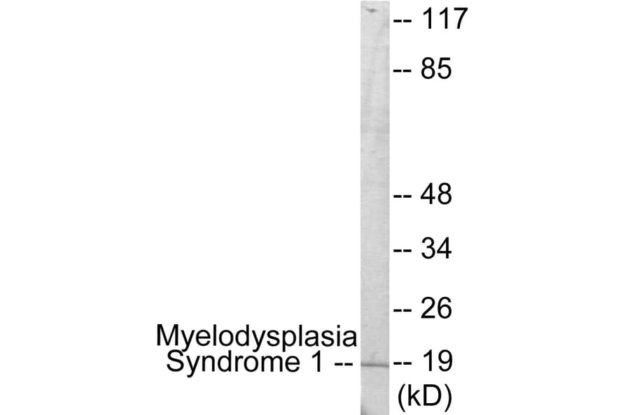 Western Blot - Myelodysplasia Syndrome 1 Cell Based ELISA Kit (CB5991) - Antibodies.com