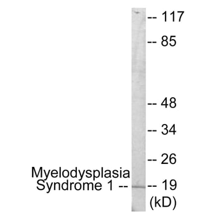Western Blot - Myelodysplasia Syndrome 1 Cell Based ELISA Kit (CB5991) - Antibodies.com