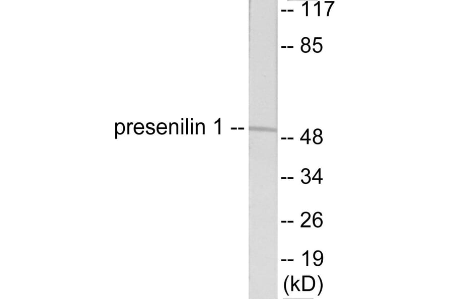 Western Blot - Presenilin 1 Cell Based ELISA Kit (CB5755) - Antibodies.com