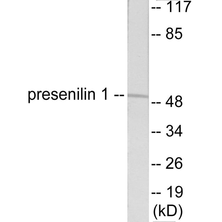 Western Blot - Presenilin 1 Cell Based ELISA Kit (CB5755) - Antibodies.com