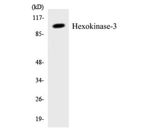 Western Blot - Hexokinase 3 Cell Based ELISA Kit (CB5918) - Antibodies.com