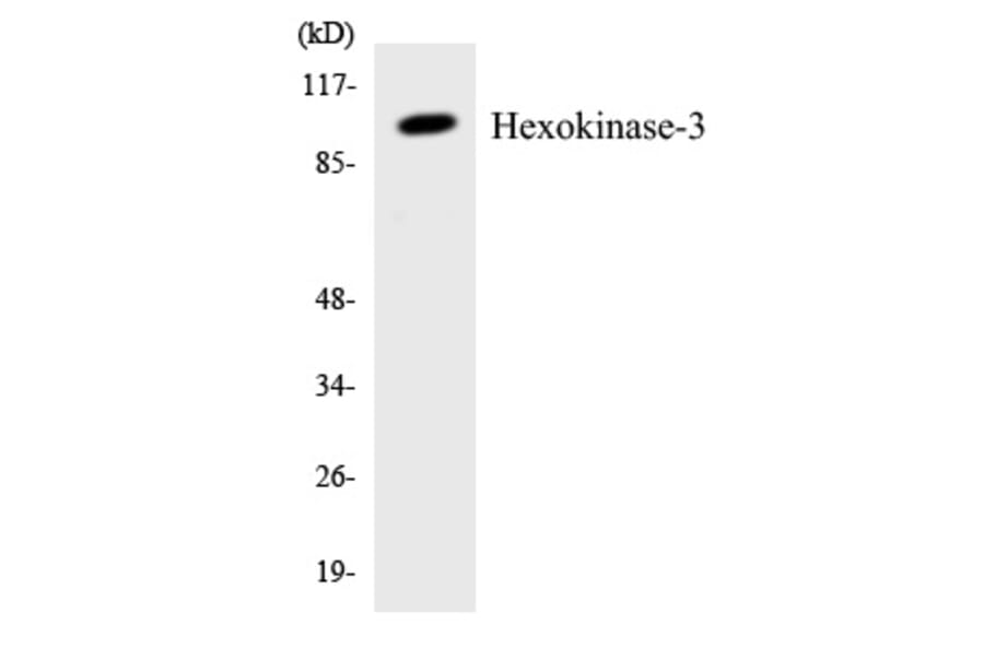 Western Blot - Hexokinase 3 Cell Based ELISA Kit (CB5918) - Antibodies.com