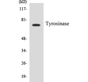 Western Blot - Tyrosinase Cell Based ELISA Kit (CB5711) - Antibodies.com