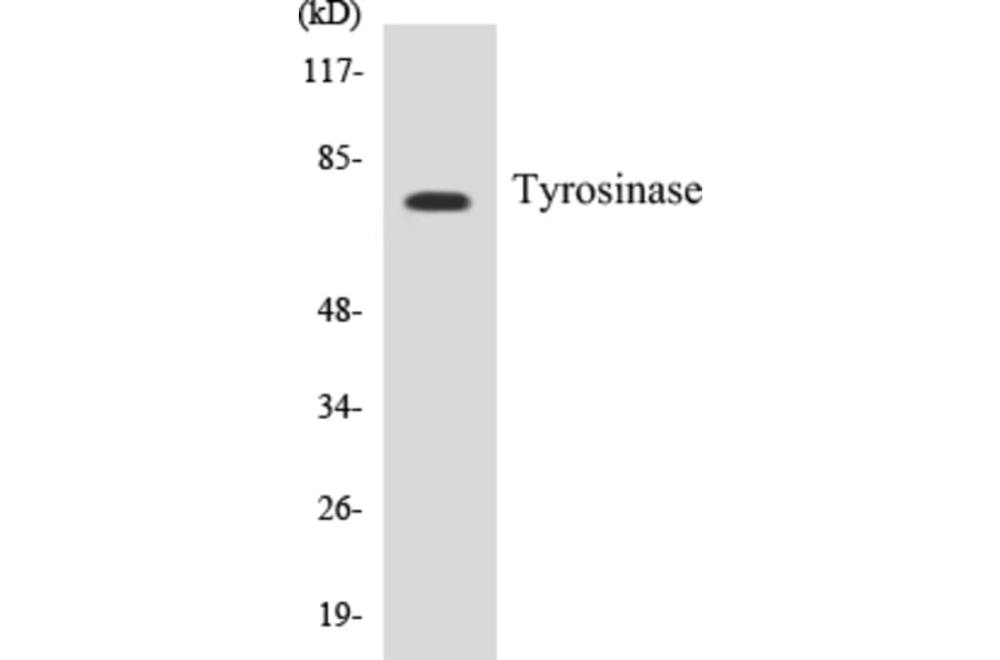 Western Blot - Tyrosinase Cell Based ELISA Kit (CB5711) - Antibodies.com
