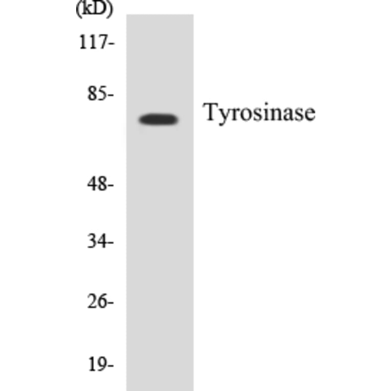 Western Blot - Tyrosinase Cell Based ELISA Kit (CB5711) - Antibodies.com