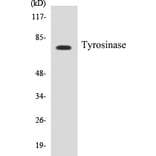 Western Blot - Tyrosinase Cell Based ELISA Kit (CB5711) - Antibodies.com