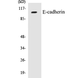 Western Blot - E-cadherin Cell Based ELISA Kit (CB5218) - Antibodies.com