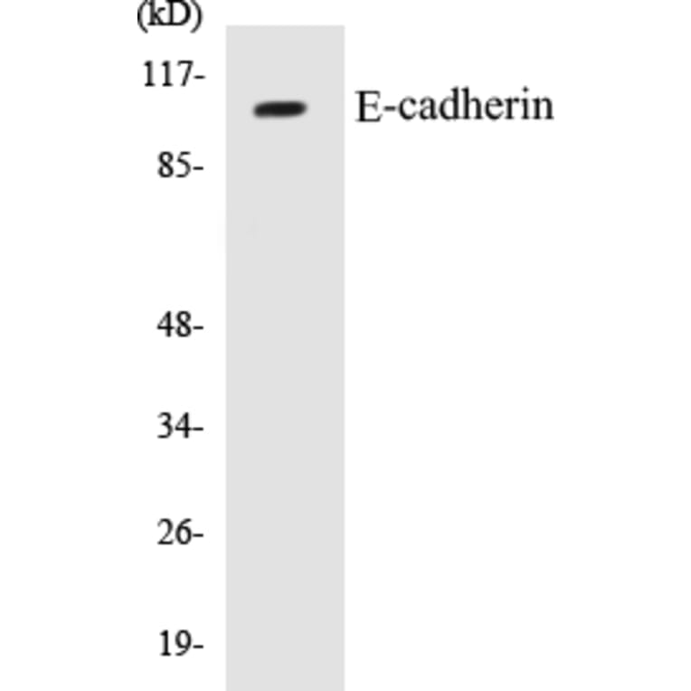 Western Blot - E-cadherin Cell Based ELISA Kit (CB5218) - Antibodies.com