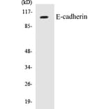 Western Blot - E-cadherin Cell Based ELISA Kit (CB5218) - Antibodies.com