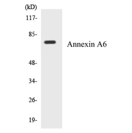 Western Blot - Annexin A6 Cell Based ELISA Kit (CB5041) - Antibodies.com