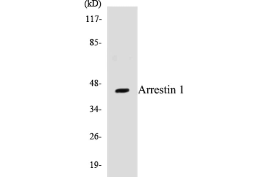 Western Blot - Arrestin 1 Cell Based ELISA Kit (CB5049) - Antibodies.com