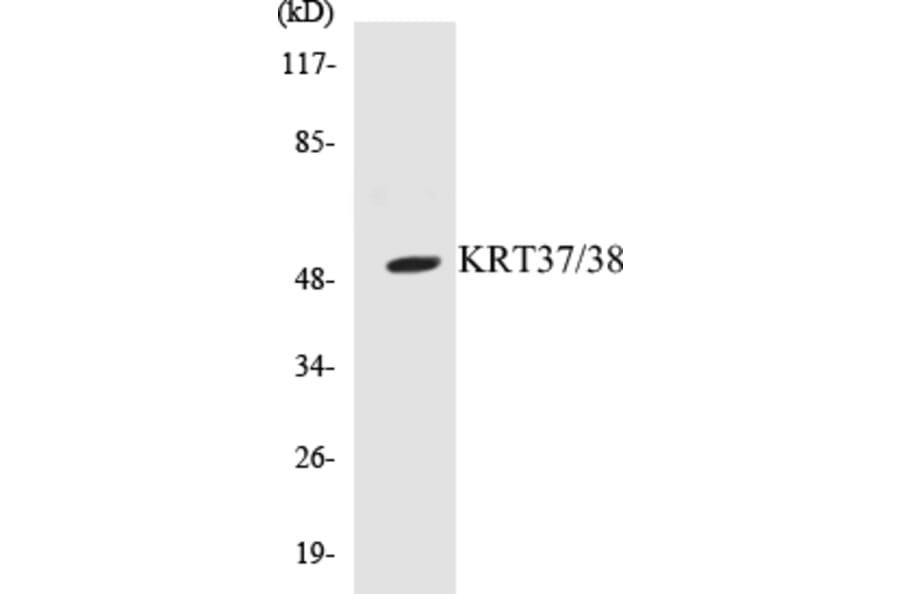Western Blot - KRT37 + 38 Cell Based ELISA Kit (CB5409) - Antibodies.com