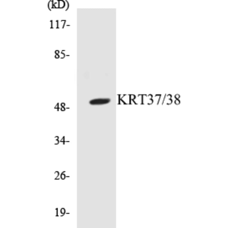 Western Blot - KRT37 + 38 Cell Based ELISA Kit (CB5409) - Antibodies.com