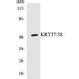 Western Blot - KRT37 + 38 Cell Based ELISA Kit (CB5409) - Antibodies.com