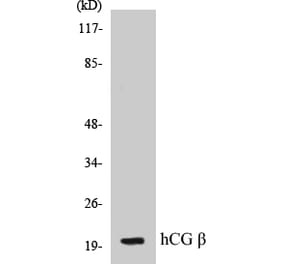Western Blot - hCG beta Cell Based ELISA Kit (CB5317) - Antibodies.com