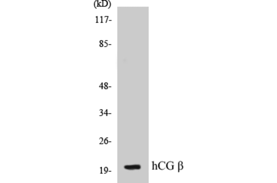 Western Blot - hCG beta Cell Based ELISA Kit (CB5317) - Antibodies.com