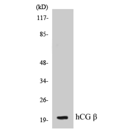 Western Blot - hCG beta Cell Based ELISA Kit (CB5317) - Antibodies.com